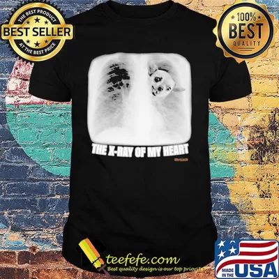 Chihuahua the x-ray of my heart shirt