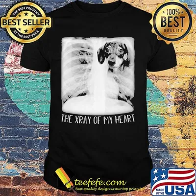 Pointer the xray of my heart shirt