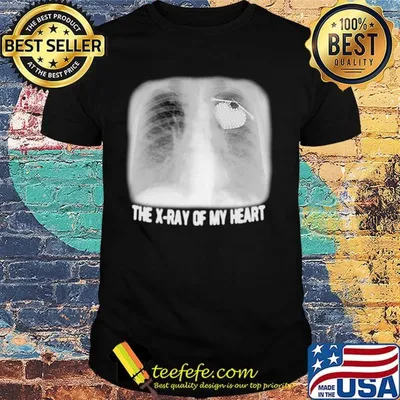 The X-ray Of My Heart Black White Shirt