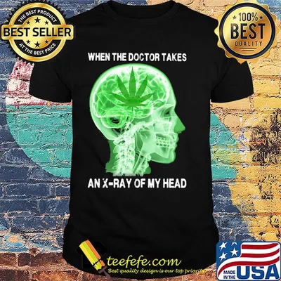 Weed when the doctor takes an x ray of my head shirt
