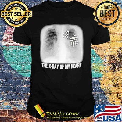 The X-ray of my heart racing shirt